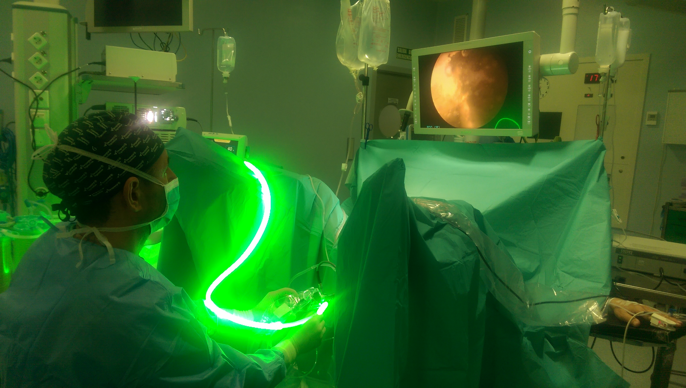 laser verde