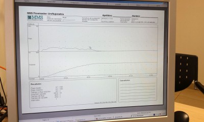 Registro flujometría en pantalla