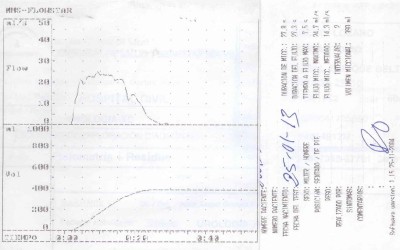 Registro flujometría obtenido en Hospital Civil (Carlos Haya)