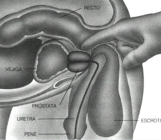 hiperplasia adenomatosa de próstata)