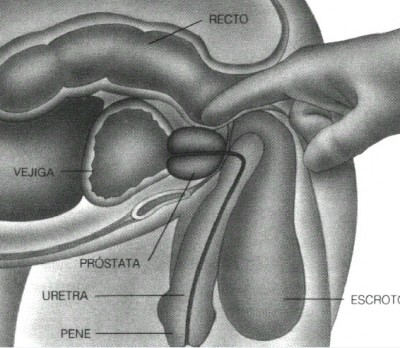 Tacto rectal. Palpación de la próstata 