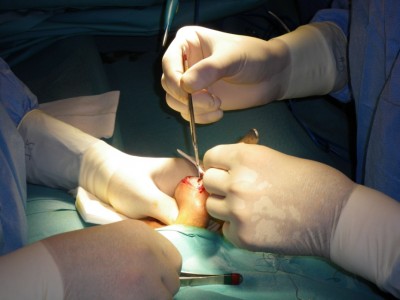 Dr. Gómez Pascual realizando una biopsia testicular a un paciente en Hospital Quirón Málaga