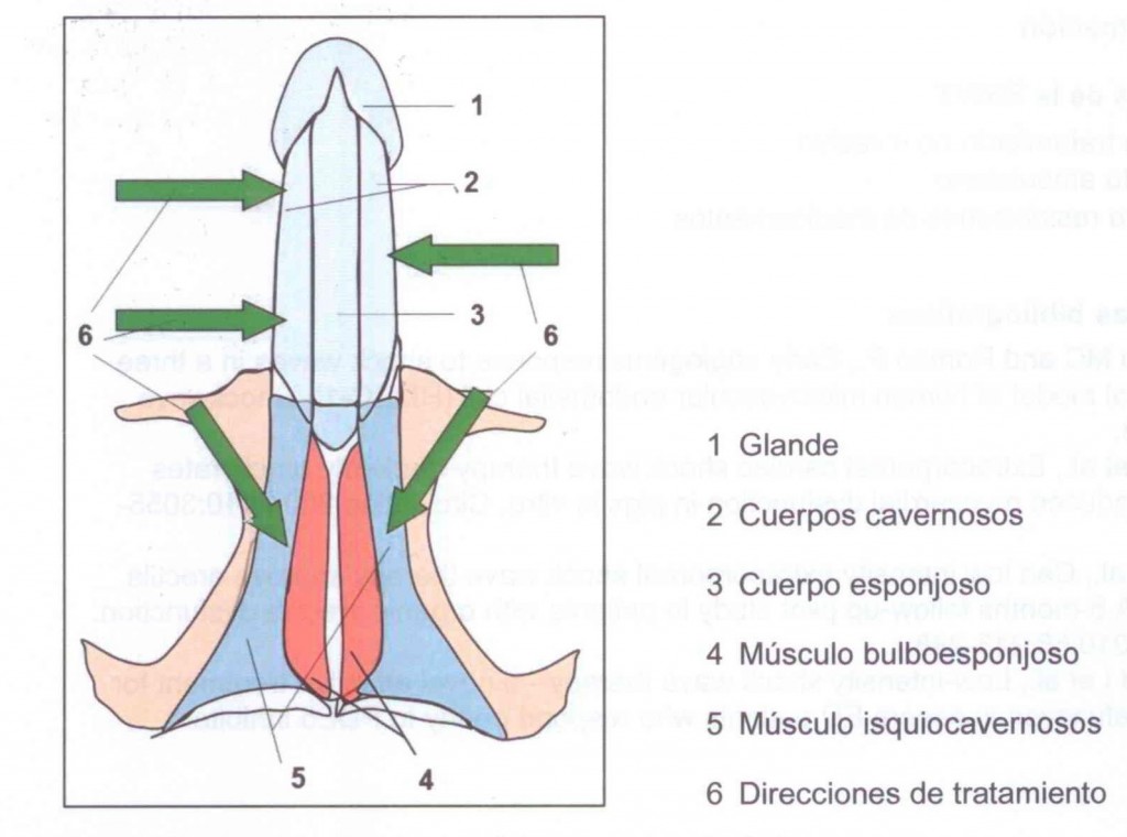 Diferentes zonas anatómicas y sentido de la aplicación de las ondas durante el tratamiento de la Disfunción eréctil