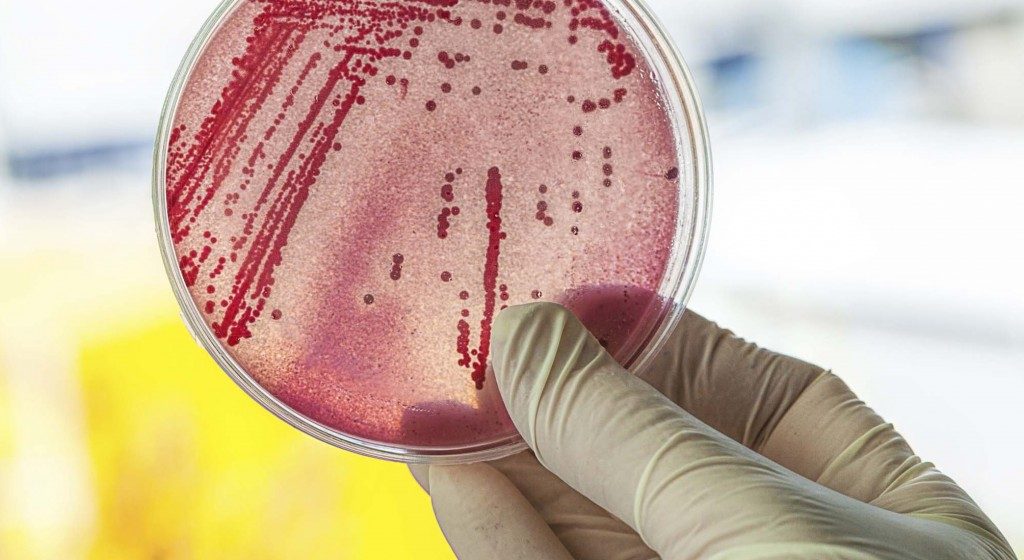 Lehetséges-e gyógyítani krónikus bakteriális prosztatitist antibiotikumok nélkül?