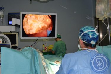 rtu-prostata-litofragmentacion-laser-holmio-03