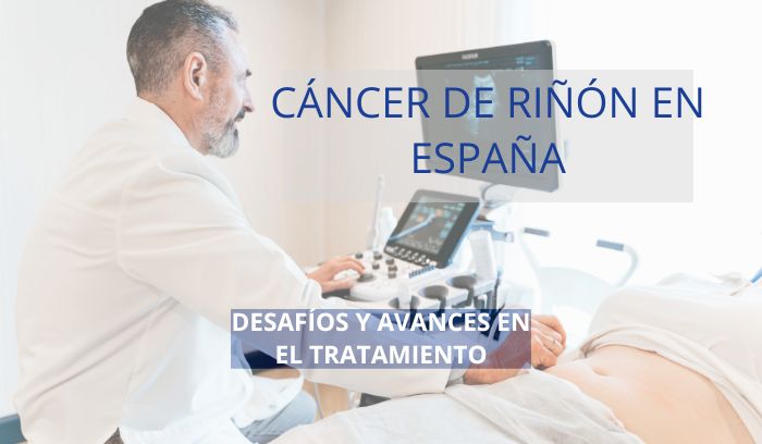 Cáncer de Riñón en España