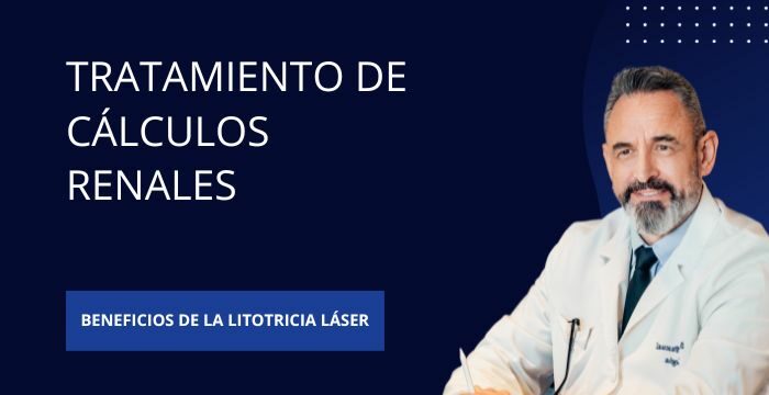 Litotricia Láser en España